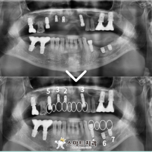 반여동치과추천 스마트치과