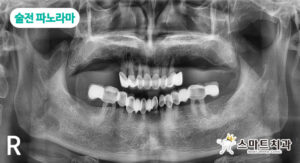 반송치과 스마트치과