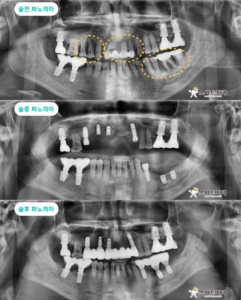 반여동치과추천 스마트치과