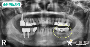반여동임플란트치과 스마트치과