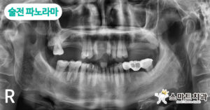 재송동치과 스마트치과