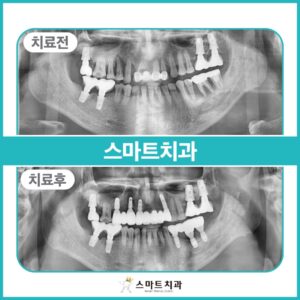반여동치과추천 스마트치과