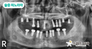반송치과 스마트치과