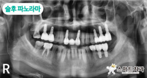 재송동치과 스마트치과
