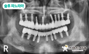 반송치과 스마트치과