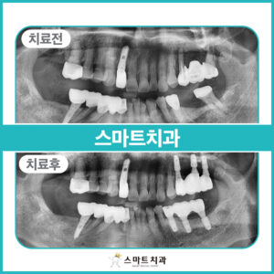 증례