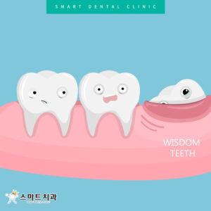 재송동추천치과 스마트치과