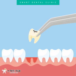 반여동충치치과 스마트치과
