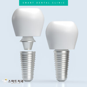 반여동치과추천 스마트치과