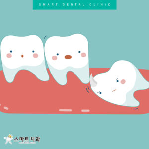 재송동추천치과 스마트치과