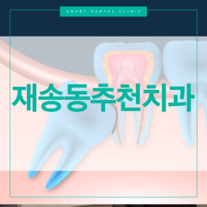 재송동추천치과 스마트치과