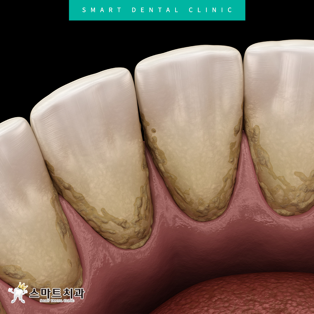 반여동스케일링치과