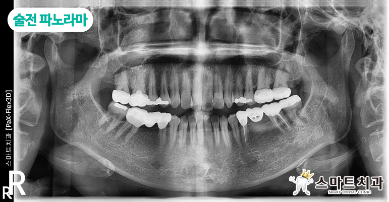 안락동임플란트치과
