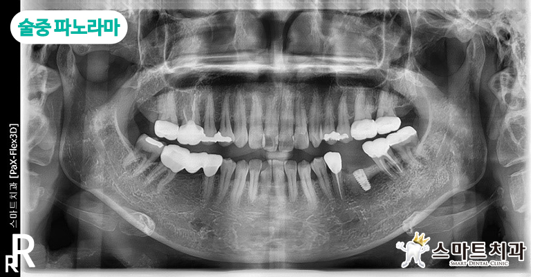 안락동임플란트치과