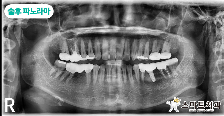 안락동임플란트치과