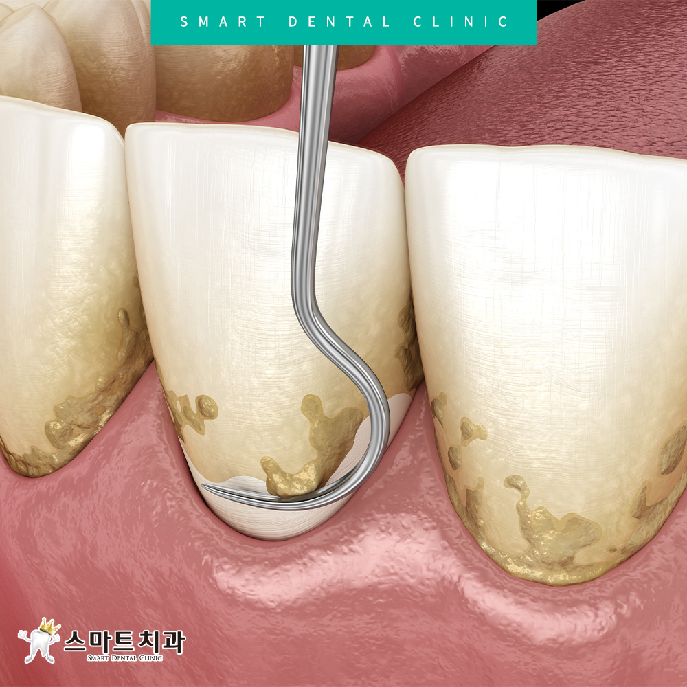 서동스케일링치과