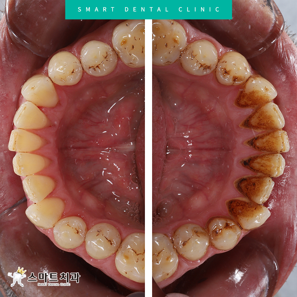 서동스케일링치과
