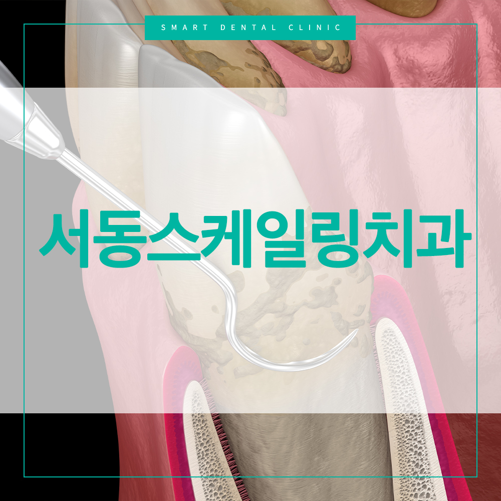 서동스케일링치과